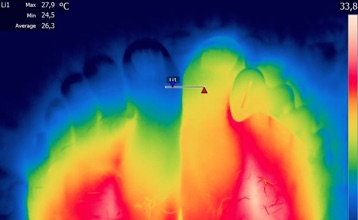 Foot Temperature And Blood Flow Wearing Correct Toes (R) vs Without (L)